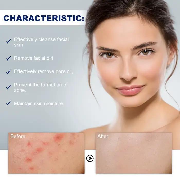 Nettoyant pour le visage Anti-acné