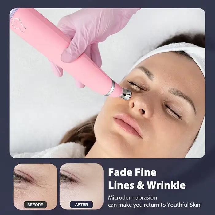 Appareil de peeling facial anti-âge Diamond MicrodermDelhi, élimination des points noirs, tonificati