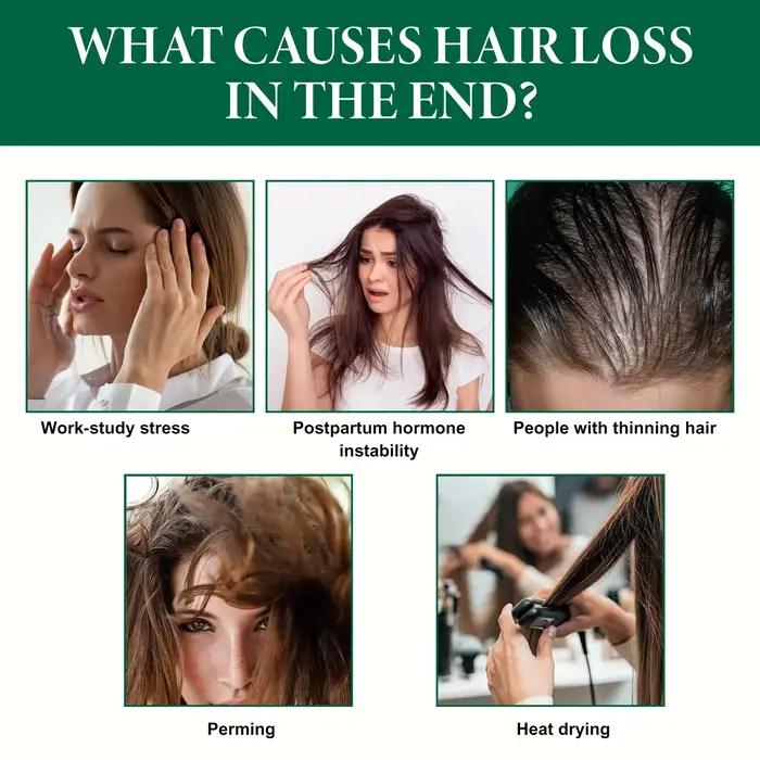 Fluide anti-chute de cheveux au gingembre 30ml - Combat la calvitie