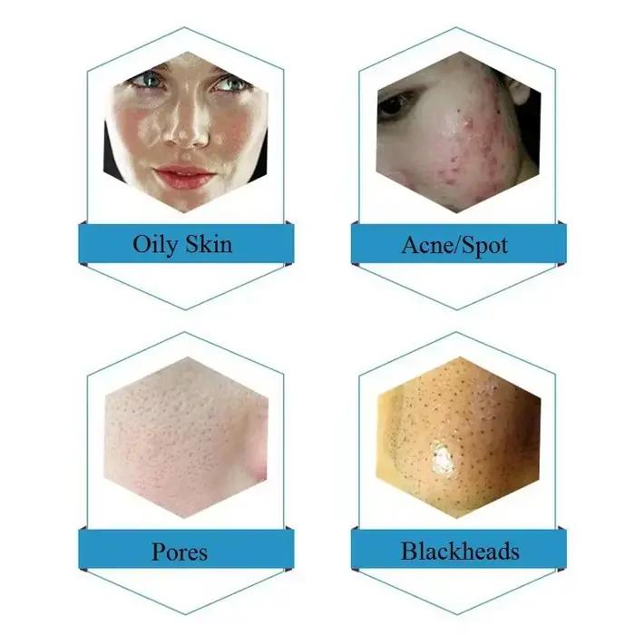 Solution professionnelle dermabrasion, sérum pour le visage Aqua 50ml pour machines de soins de la peau, traitement hydratant et nettoyant en profondeur pour Salon