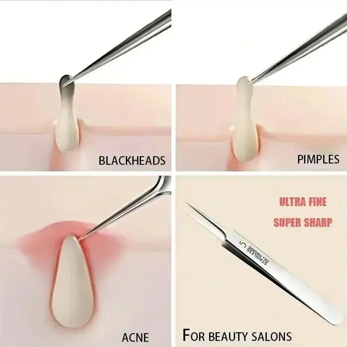 Pince extra fine n ° 5 pour les soins de la peau, accessoire pour éliminer l'acné, les points noirs, la beauté du visage, 1 pièce
