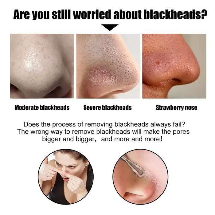 Peel Off points noirs supprimer les bandes de nez de plâtre tirer le masque noir pour la beauté des femmes