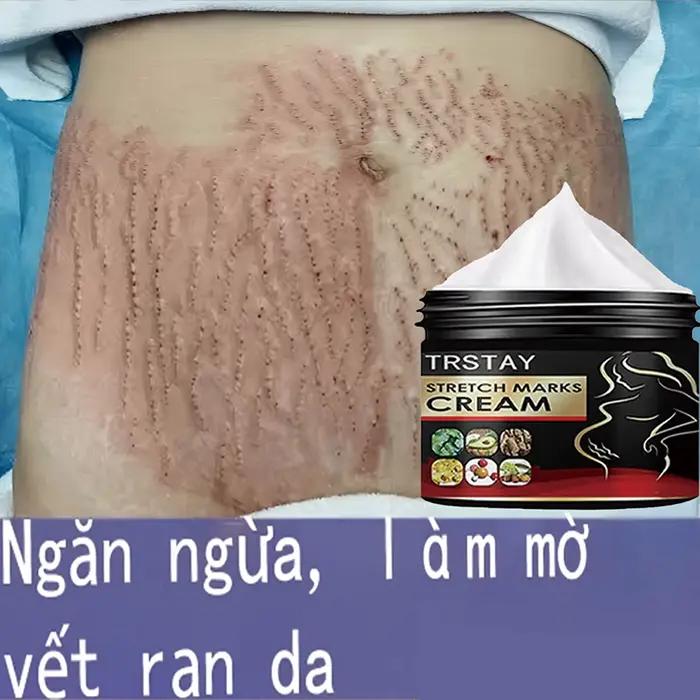 TRSTAY crème contre les vergetures pour la peau de grossesse reconstituer et réparer la Promotion de