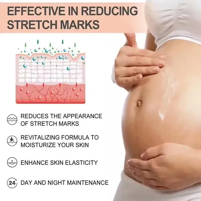 Sérum réparateur de vergetures pour femmes enceintes, soins post-partum, lignes lumineuses fermes, lignes d'obésité, lignes de croissance, crème réparatrice, nouveau