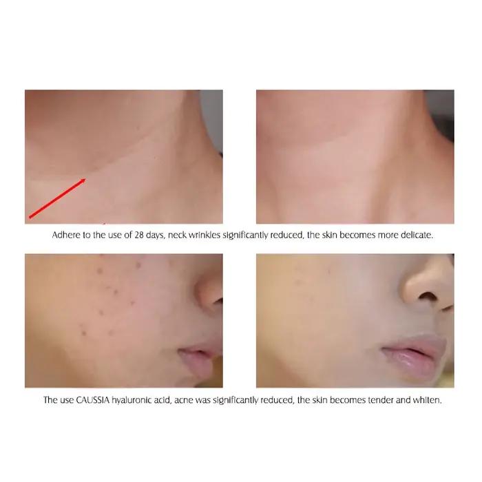 Sérum facial à l'acide hyaluronique