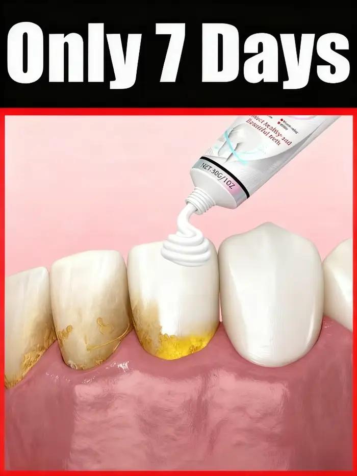 Réparer les dents, prévenir les caries et éliminer efficacement la plaque dentaire