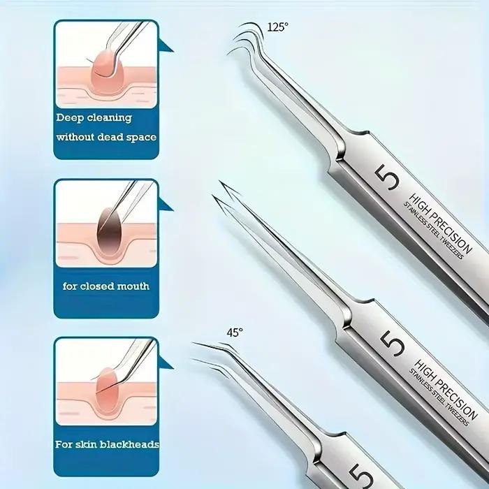 3/5/8 Pcs Pinces ultra-fines pour l'acné, extracteur de points noirs, aiguille à acné, nettoyant facial pour la peau