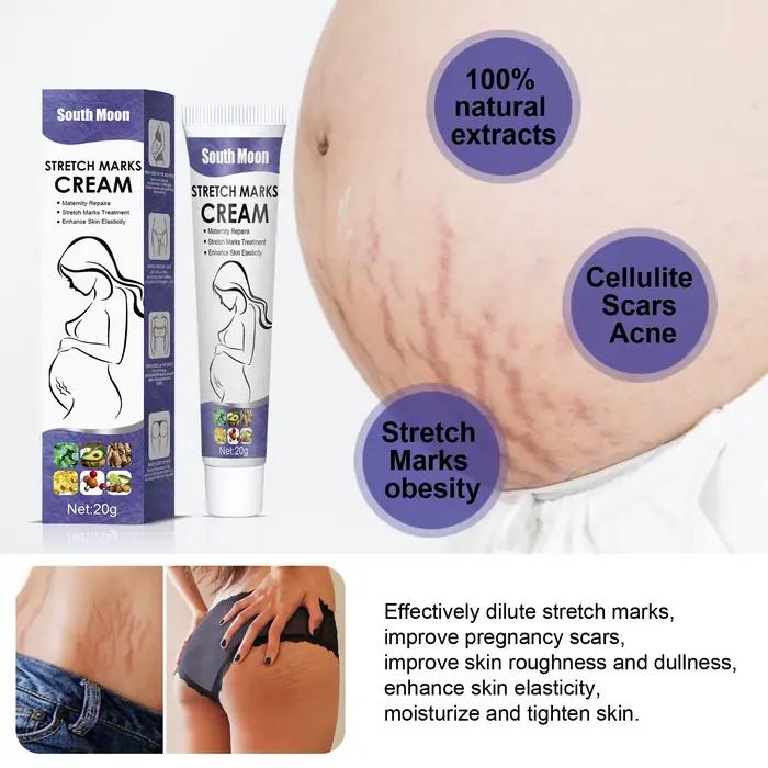 Crème anti-vergetures pour femmes enceintes et post-partum améliorant l'élasticité et estompant les cicatrices de grossesse