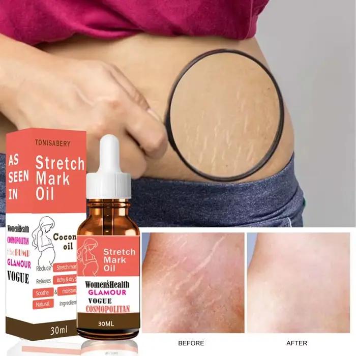 Sérum réparateur de vergetures pour femmes enceintes, soins post-partum, lignes lumineuses fermes, lignes d'obésité, lignes de croissance, crème réparatrice, nouveau