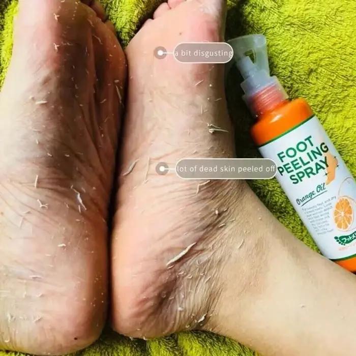 Spray pour les pieds 100 ml